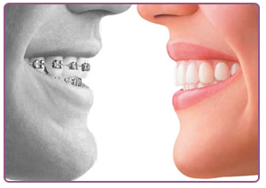 Corregir los dientes nunca fué tan cómodo