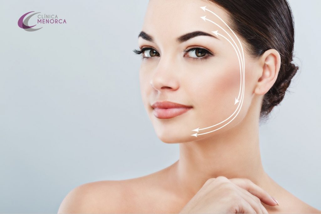 Qué tipos de lifting facial existen?