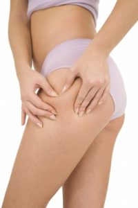 radiofrecuencia contra la celulitis
