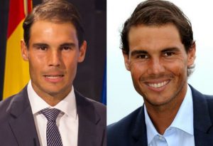 fotos rafa nadal antes y después de trasplante capilar en Clínica Menorca