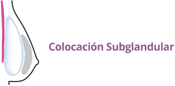 Colocacion implantes mamarios subglandular