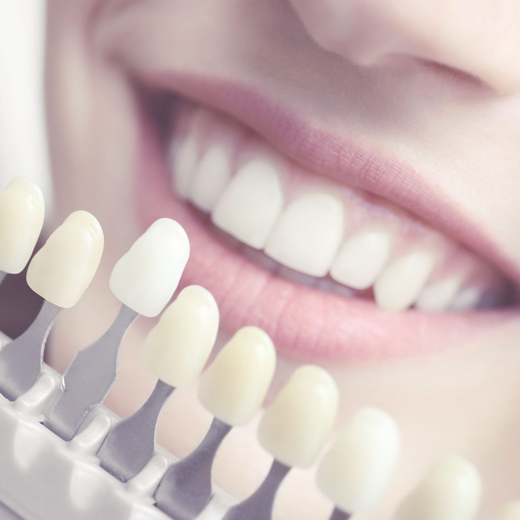 Blanqueamiento dental