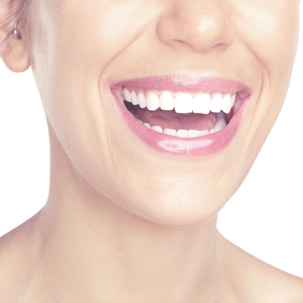 Diseño de la sonrisa en 3d