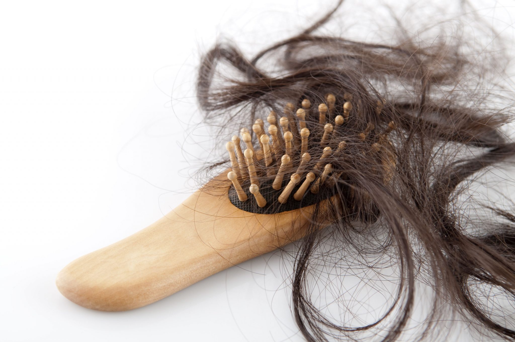 Solución la calvicie en hombres y mujeres: adiós a la alopecia
