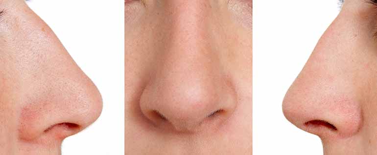 6 tipos de nariz: clases y formas ? ¡identifica la tuya!