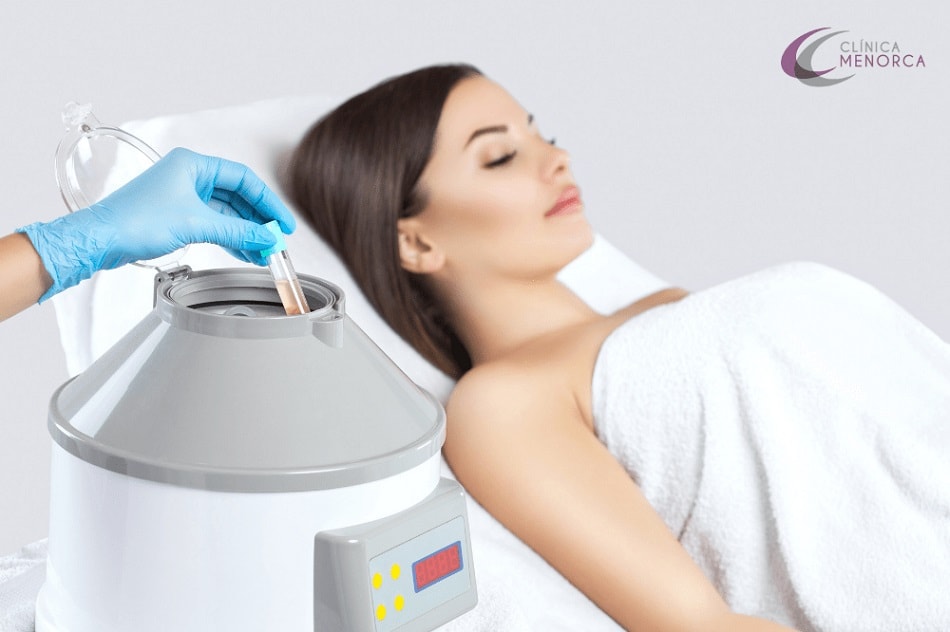 prp facial