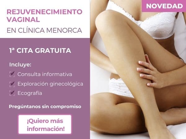Rejuvenecimiento vaginal en Clínica Menorca