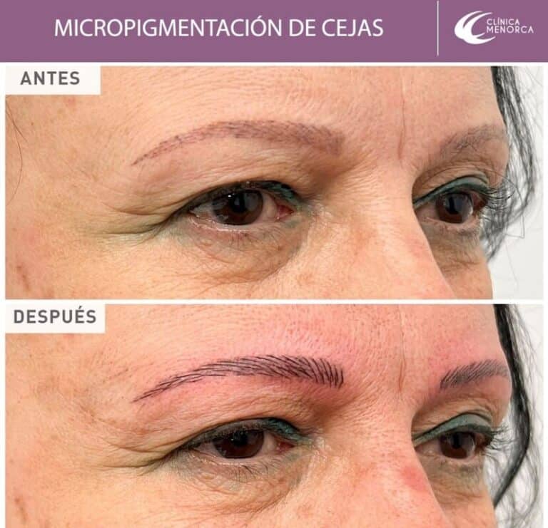 cm-micropigmentacion-1