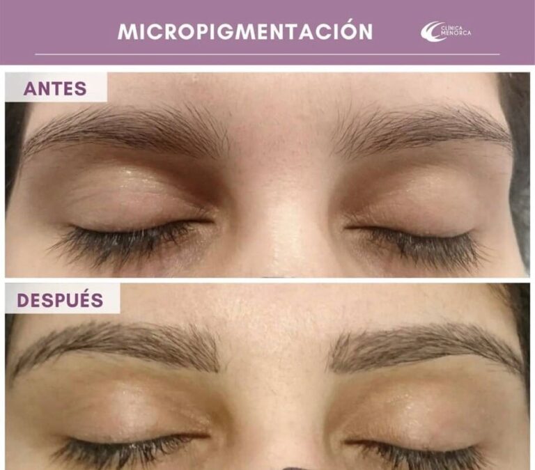 cm-micropigmentacion-4