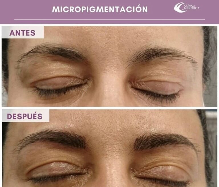 cm-micropigmentacion-6